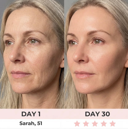 7-in-1 LED Facial Rejuvenator™