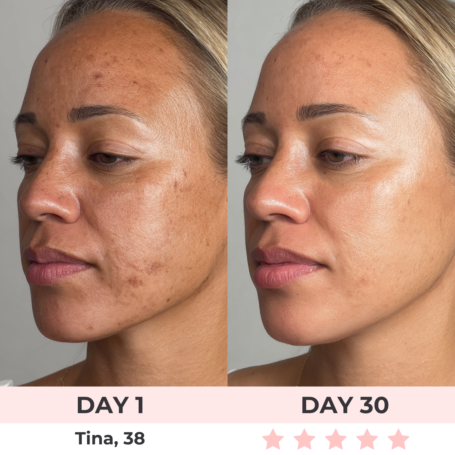 Lux Cove 7-in-1 LED Facial Sculptor